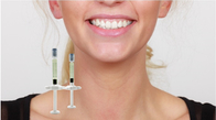 Plumper Lips Trattamento per iniezione con filler cutaneo Acido ialuronico