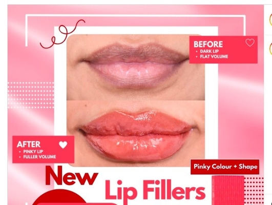 HYDROIAM Kiss con B12 Ha Filler Red Lips Filler Hyaluronic Acid Filler Fornisce Volume e Colore Naturali