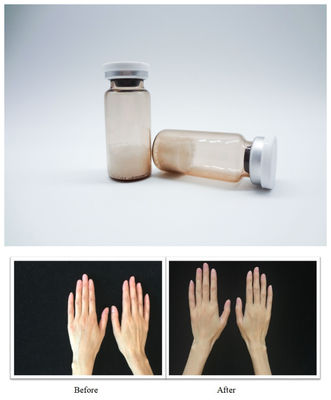 Gel iniettabile per riempimento cutaneo con acido ialuronico consente a professionisti di realizzare sculture facciale precise e una texture cutanea liscia