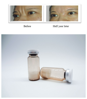 Iniezionabile PLLA Poli-L-Lactic Acid Dermal Filler Rimuove le rughe del viso Stimola la rigenerazione del collagene