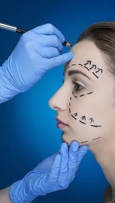 Ridurre le rughe e definire la linea della mascella con riempitivi per il viso 70% HA Cross Linked 24mg 30% Calcio idrossilapatico