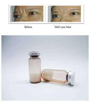 Gel iniettabile non animale per riempimento cutaneo facciale a base di acido ialuronico per il trattamento sicuro delle rughe e il ripristino del volume